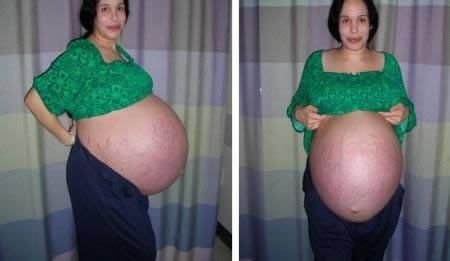 巨腹女下惊?4孩子U“章鱼妈妈
